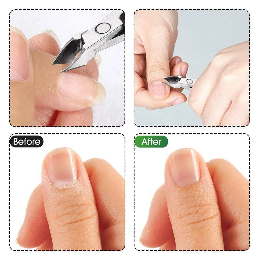 Double-ended Nails Cuticle Pusher Finger Dead Skin Remover Nail Nippers Cutter for Manicure Pedicure Accessories  Art Tools Sets